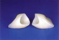 Procera crowns