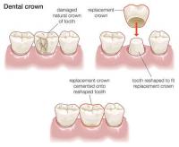 Crown