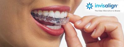 Invisalign clearalternative
